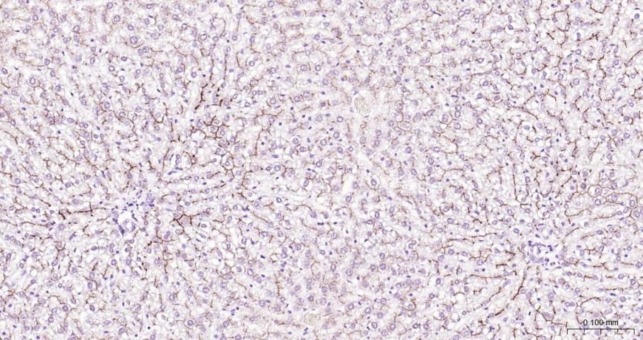多药耐药蛋白/P-糖蛋白抗体-bs-0563R
