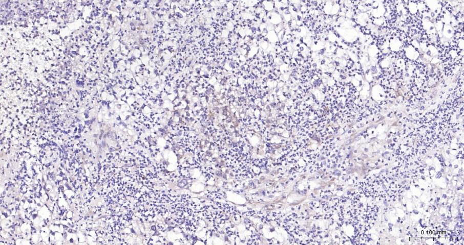 磷脂酰肌醇激酶（PI3Kβ）抗体-bs-10657R