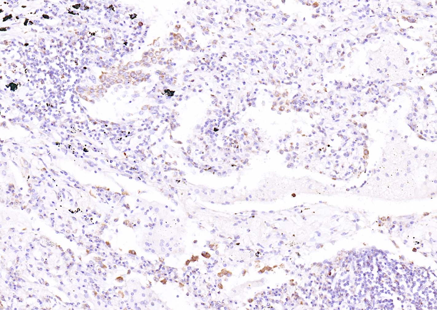 溶质转运蛋白家族44成员1抗体-bs-3667R