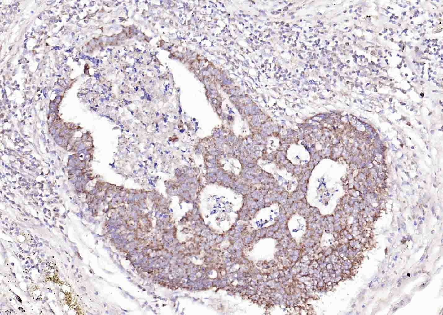 溶质转运蛋白家族44成员1抗体-bs-3667R