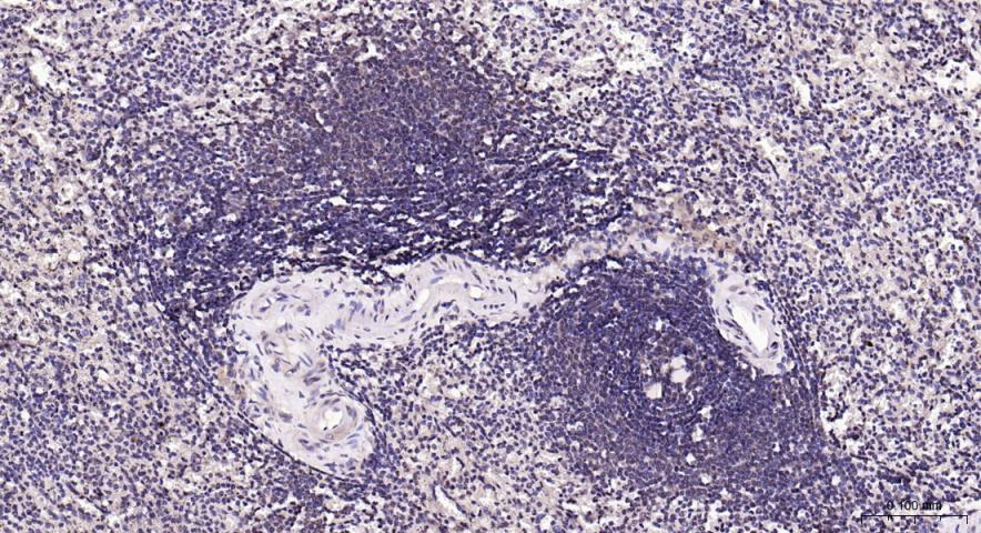 磷脂酰肌醇激酶（PI3Kβ）抗体-bs-10657R