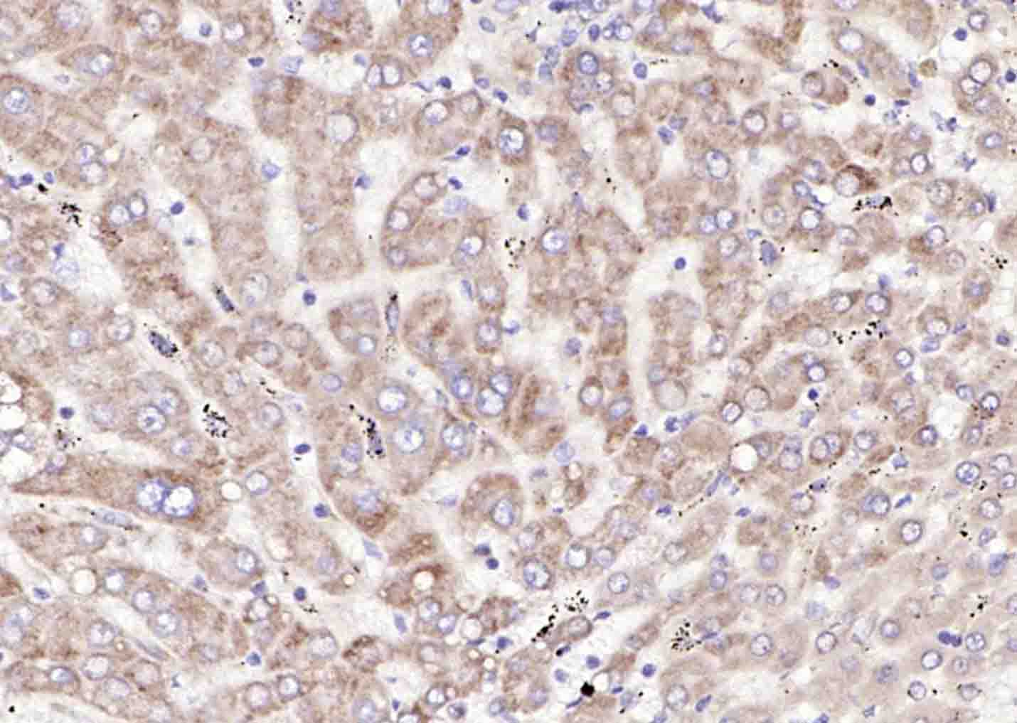 溶质转运蛋白家族44成员1抗体-bs-3667R