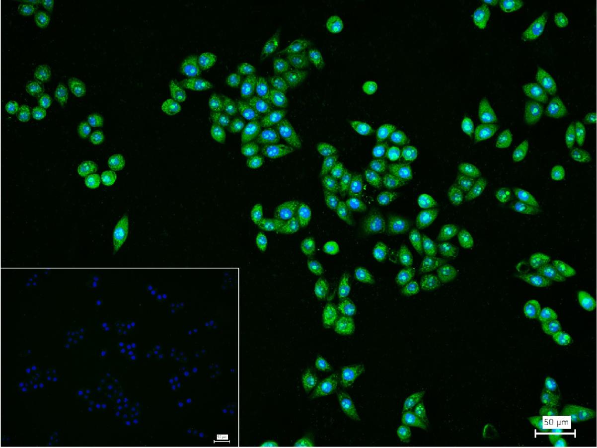 磷脂酰肌醇激酶（PI3Kβ）抗体-bs-10657R
