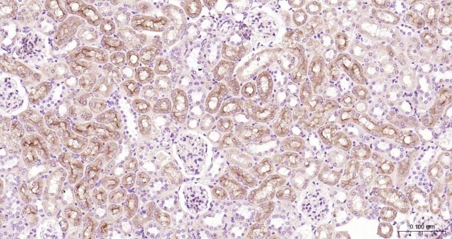 多药耐药蛋白/P-糖蛋白抗体-bs-0563R