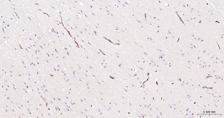 多药耐药蛋白/P-糖蛋白抗体-bs-0563R