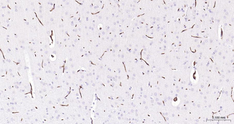 多药耐药蛋白/P-糖蛋白抗体-bs-0563R