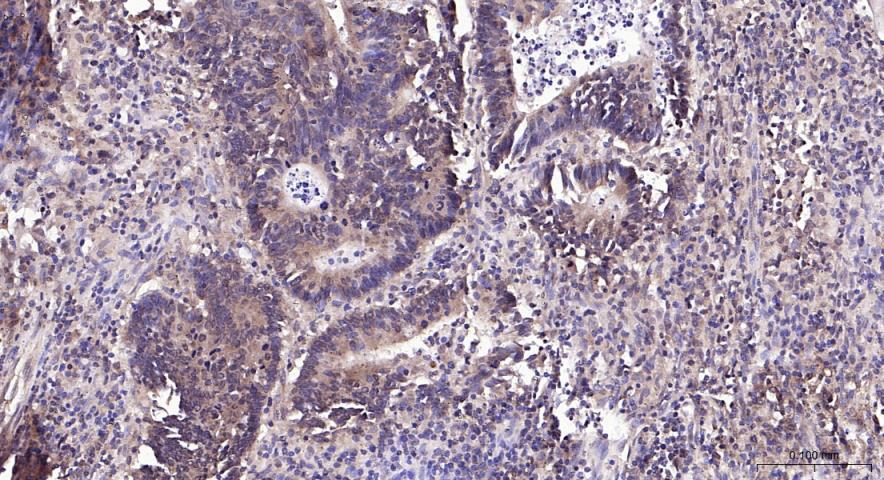 磷脂酰肌醇激酶（PI3Kβ）抗体-bs-10657R