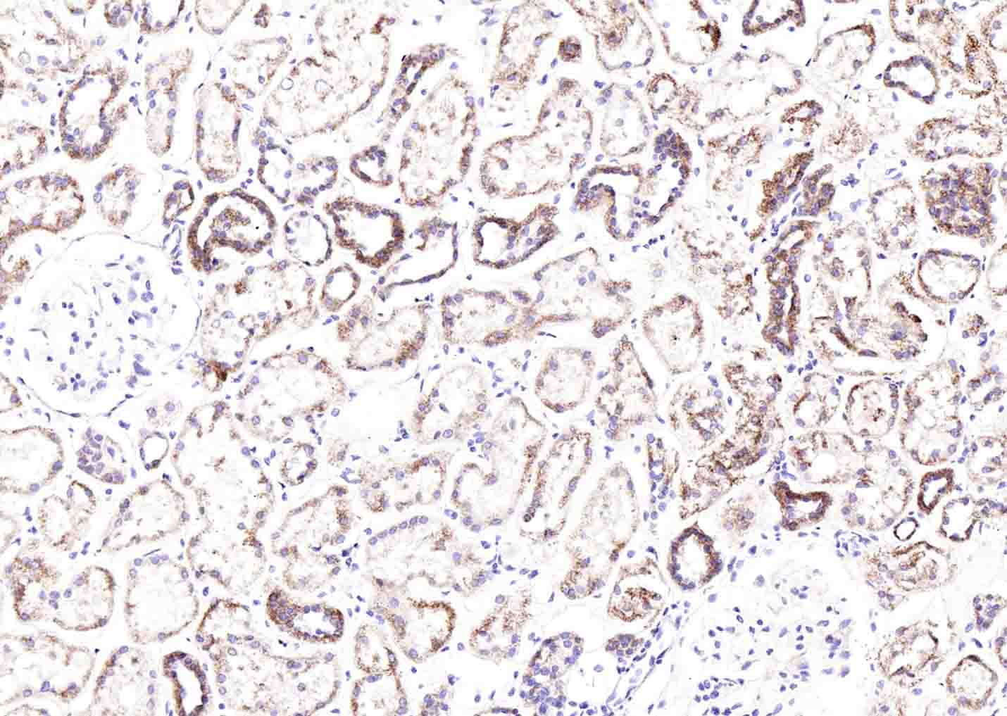 溶质转运蛋白家族44成员1抗体-bs-3667R