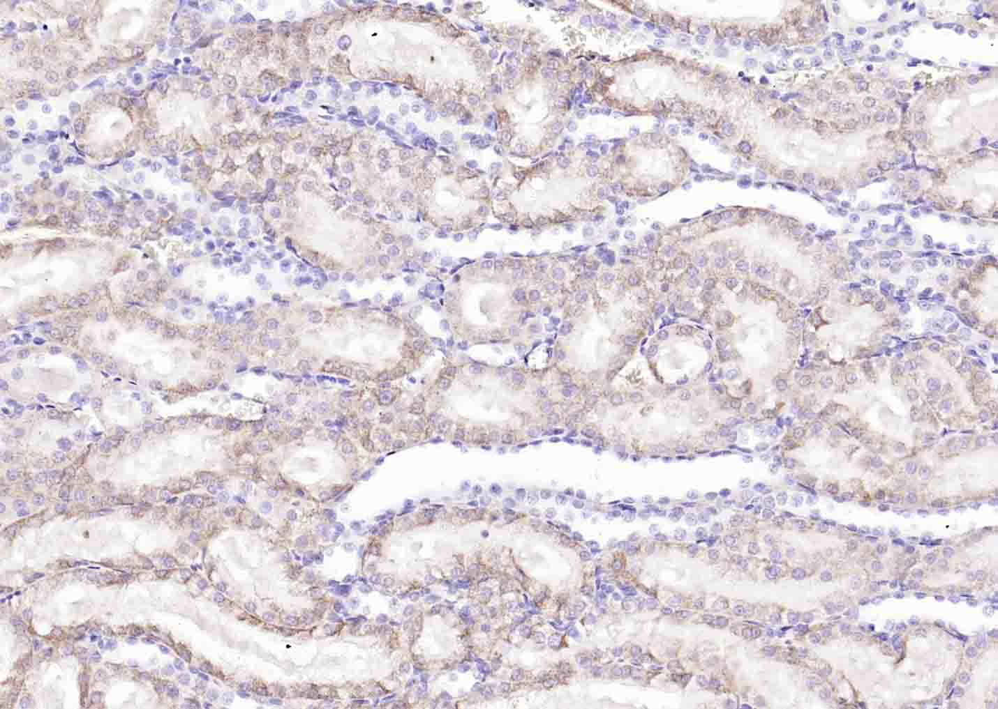 溶质转运蛋白家族44成员1抗体-bs-3667R