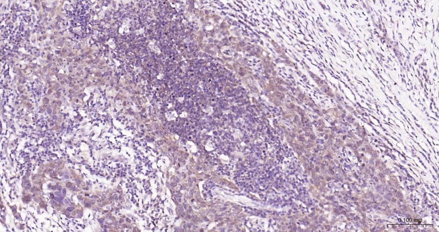 真核翻译起始因子4E重组兔单抗