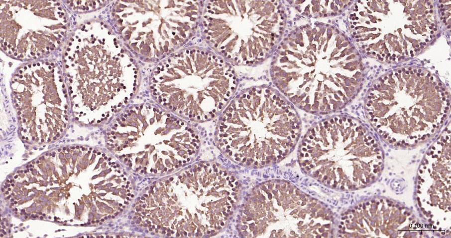 真核翻译起始因子4E重组兔单抗