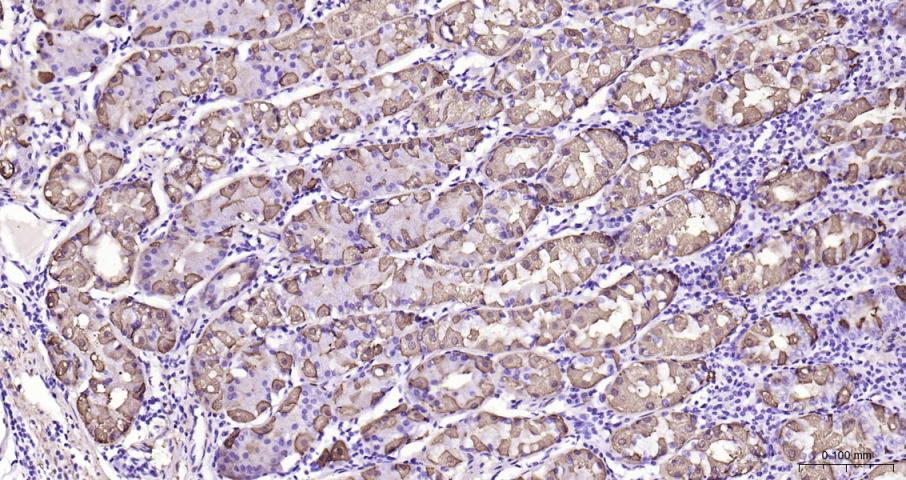 脑型肌酸激酶B型重组兔单抗