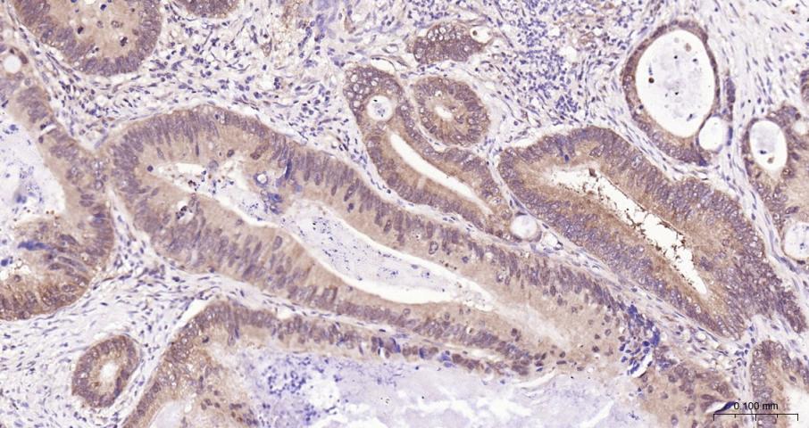 真核翻译起始因子4E重组兔单抗