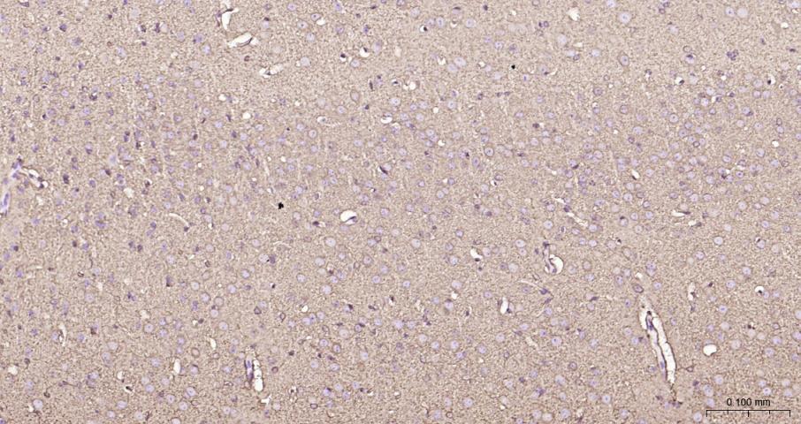 脑型肌酸激酶B型重组兔单抗