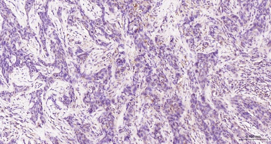真核翻译起始因子4E重组兔单抗