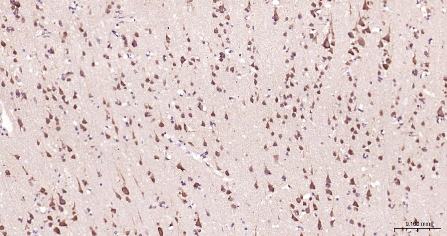 真核翻译起始因子4E重组兔单抗