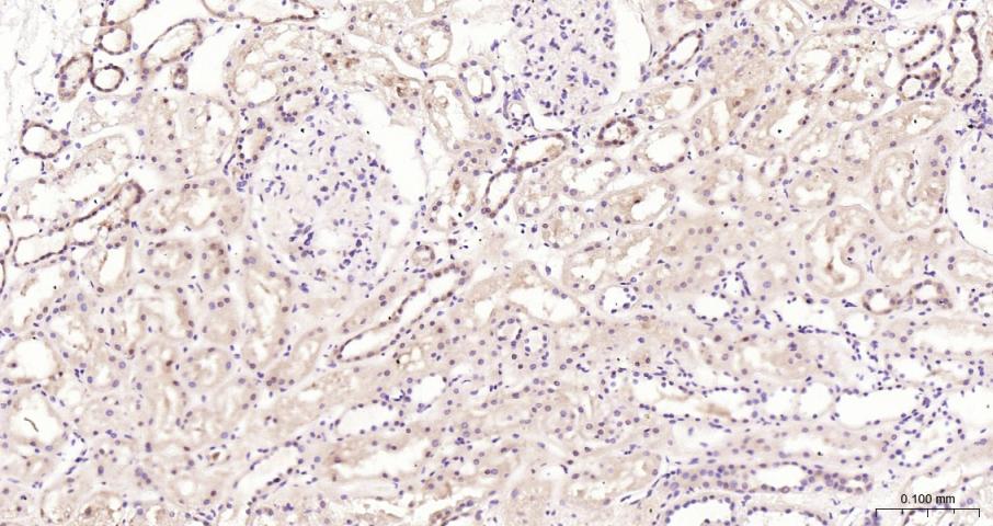真核翻译起始因子4E重组兔单抗