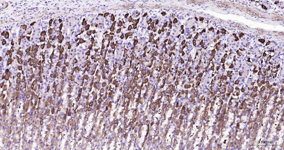 脑型肌酸激酶B型重组兔单抗