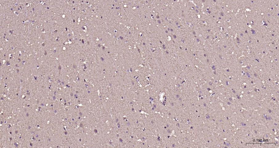 脑型肌酸激酶B型重组兔单抗