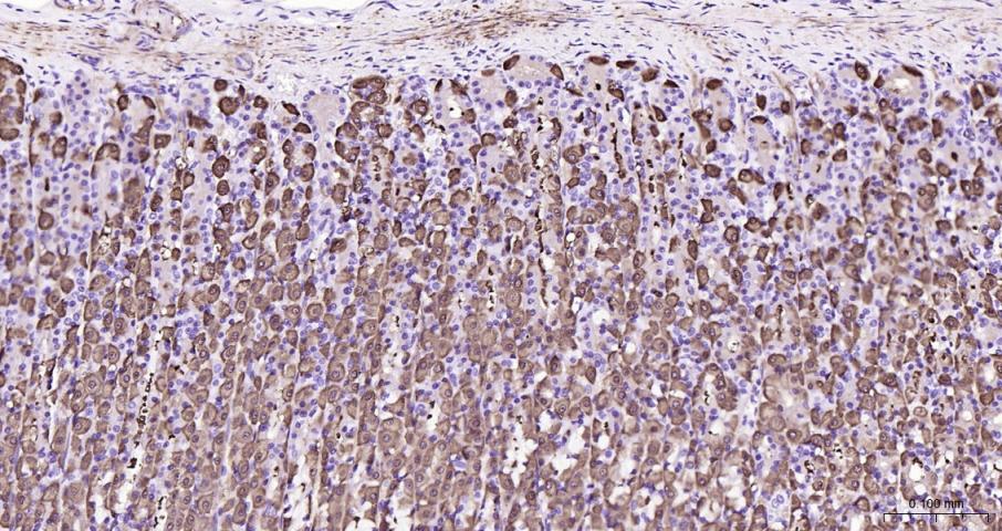 脑型肌酸激酶B型重组兔单抗