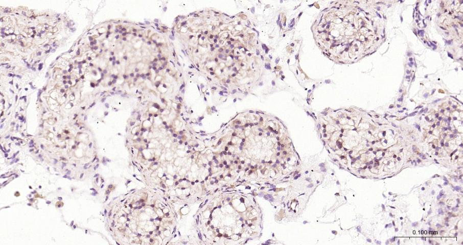 真核翻译起始因子4E重组兔单抗