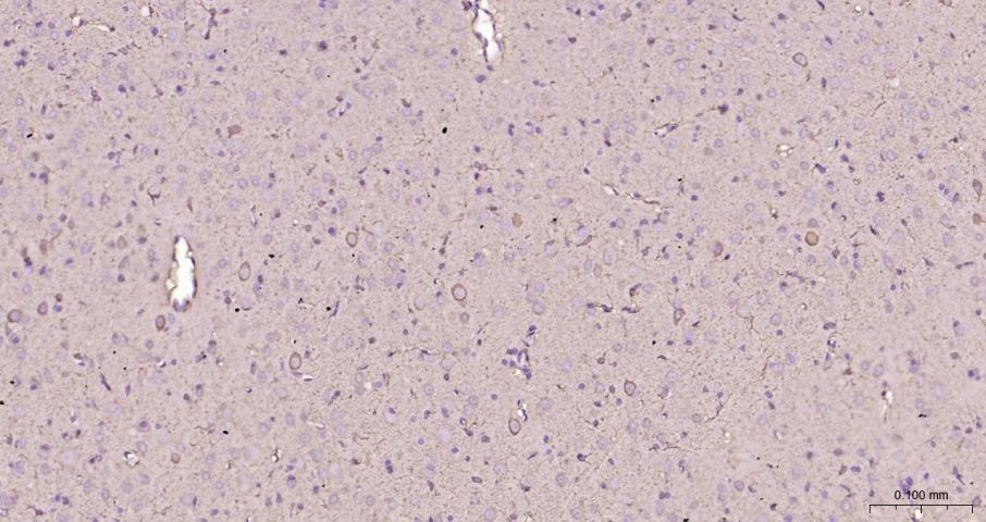 脑型肌酸激酶B型重组兔单抗