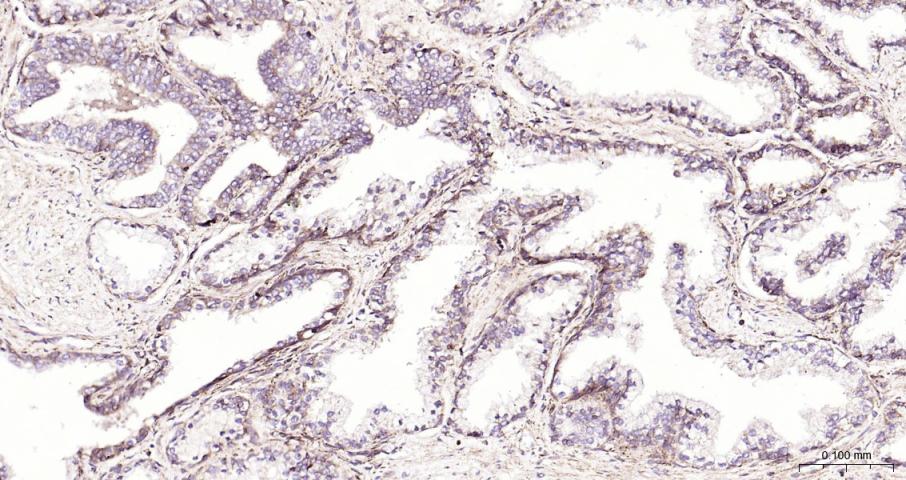 ras癌基因家族Rab5蛋白重组兔单抗-bsm-52451R