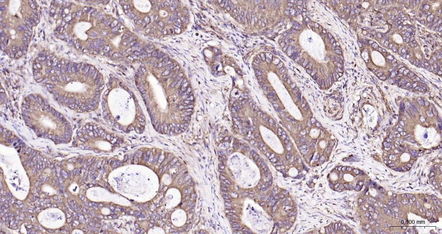 ras癌基因家族Rab5蛋白重组兔单抗-bsm-52451R
