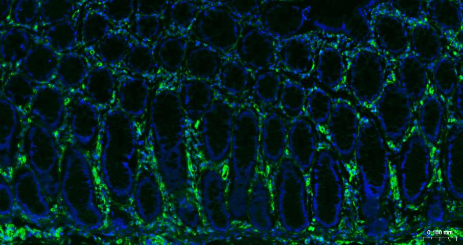 波形蛋白单克隆抗体-bsm-33170M