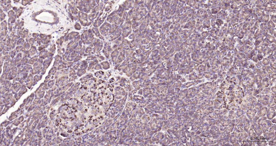ras癌基因家族Rab5蛋白重组兔单抗-bsm-52451R