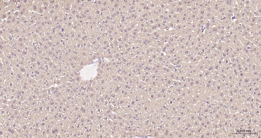 乳酸脱氢酶重组兔单抗