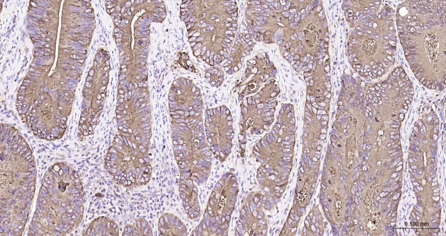 癌胚抗原重组兔单抗