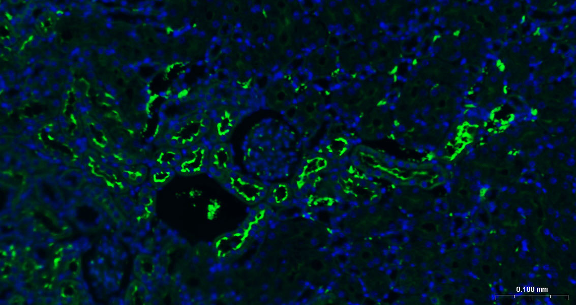 血管紧张素转换酶重组兔单抗