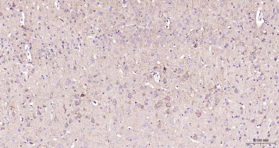 ras癌基因家族Rab5蛋白重组兔单抗-bsm-52451R