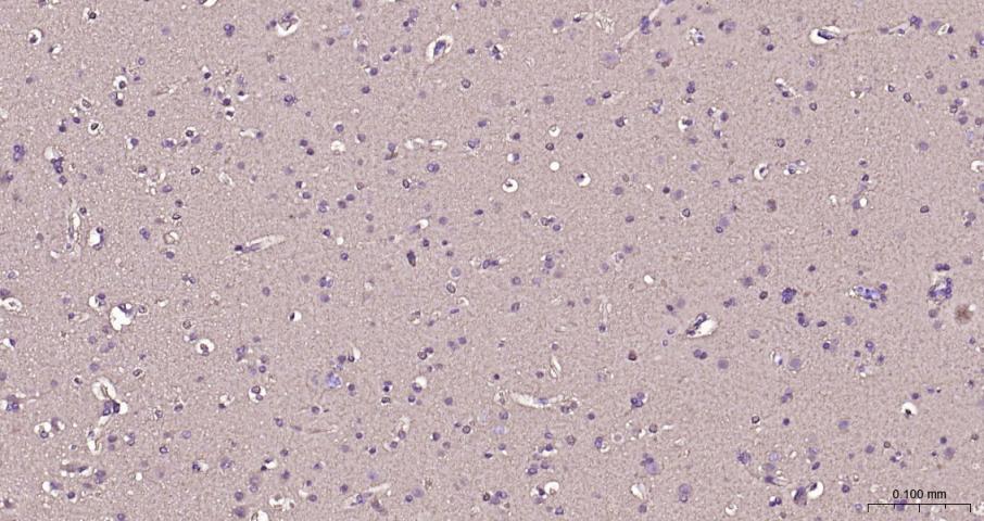 脑型肌酸激酶B型重组兔单抗