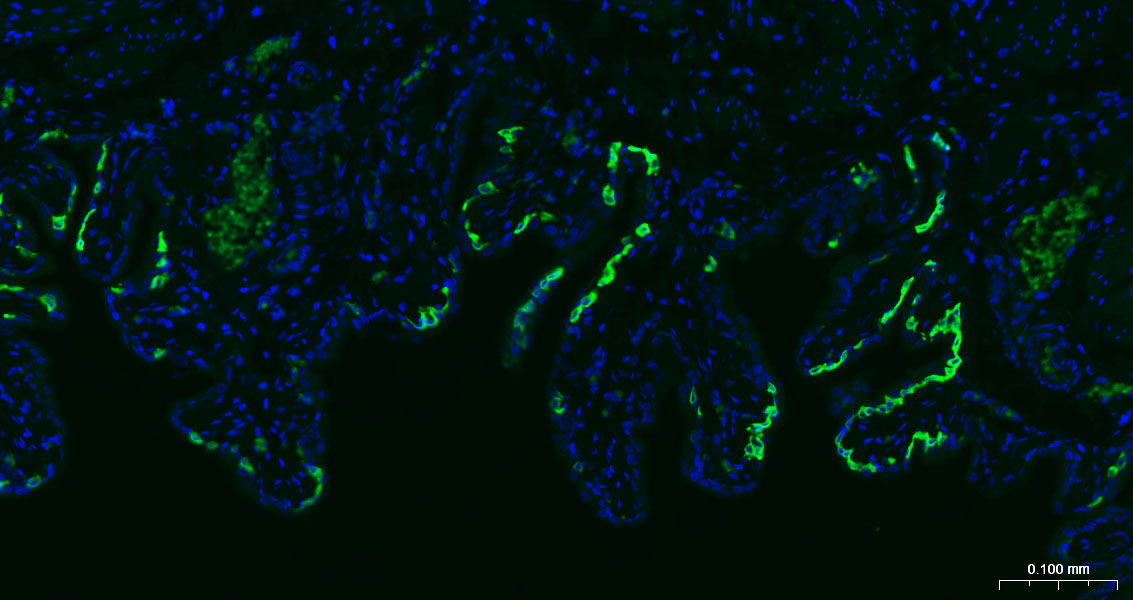 细胞角蛋白5重组兔单抗