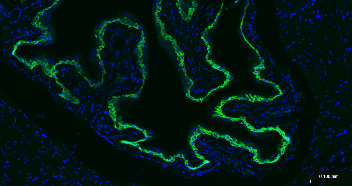 细胞角蛋白5重组兔单抗