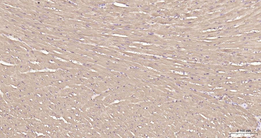 乳酸脱氢酶重组兔单抗