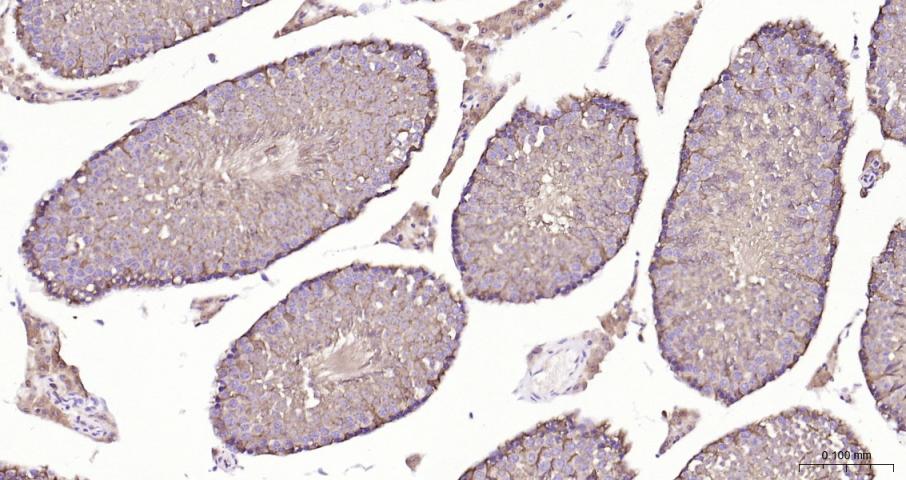 乳酸脱氢酶重组兔单抗