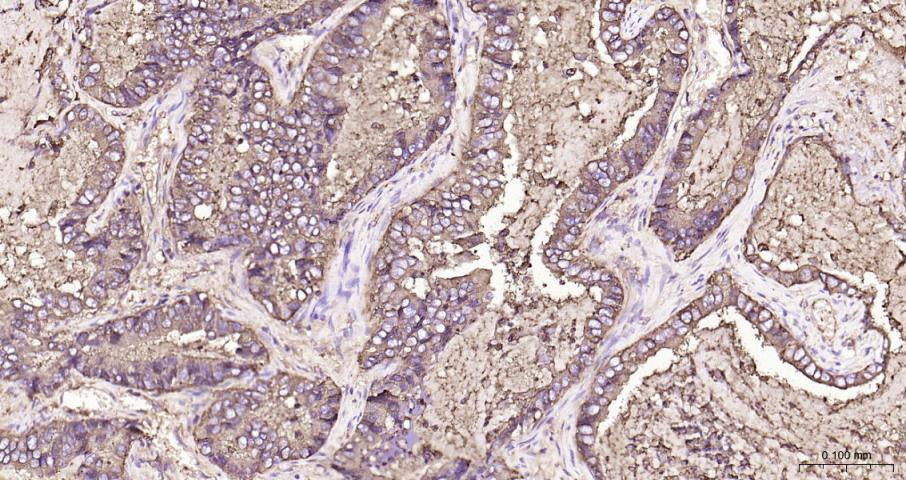 癌胚抗原重组兔单抗