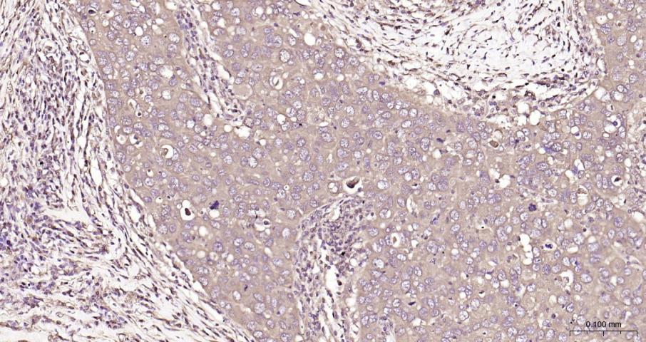 乳酸脱氢酶重组兔单抗