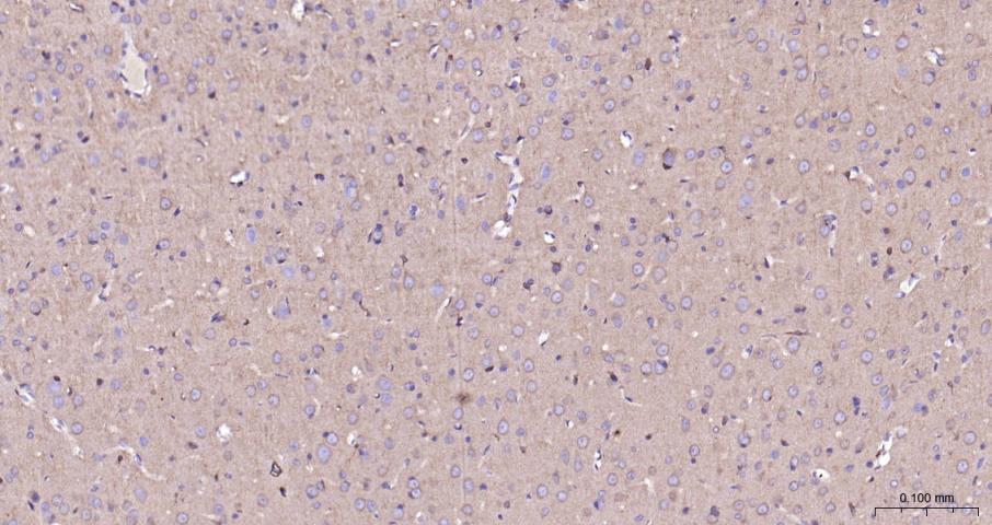 ras癌基因家族Rab5蛋白重组兔单抗-bsm-52451R