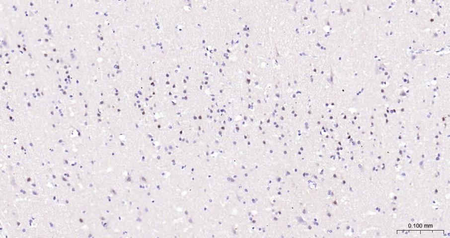 早期生长应答蛋白1重组兔单抗