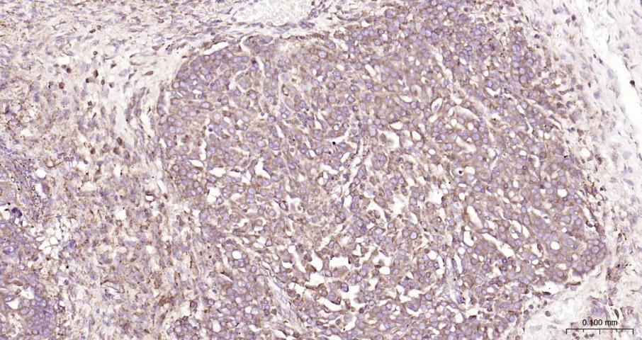 ras癌基因家族Rab5蛋白重组兔单抗-bsm-52451R