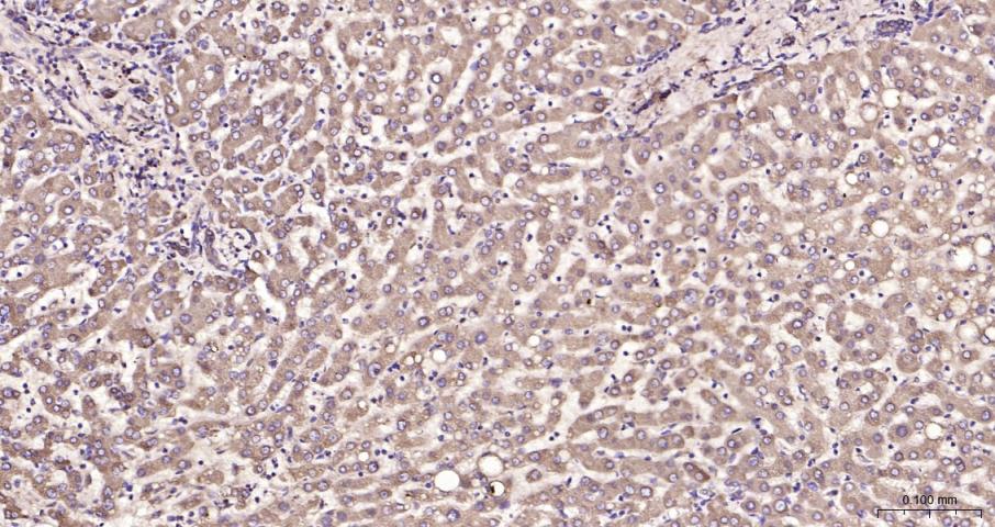 脂肪酸合成酶重组兔单抗