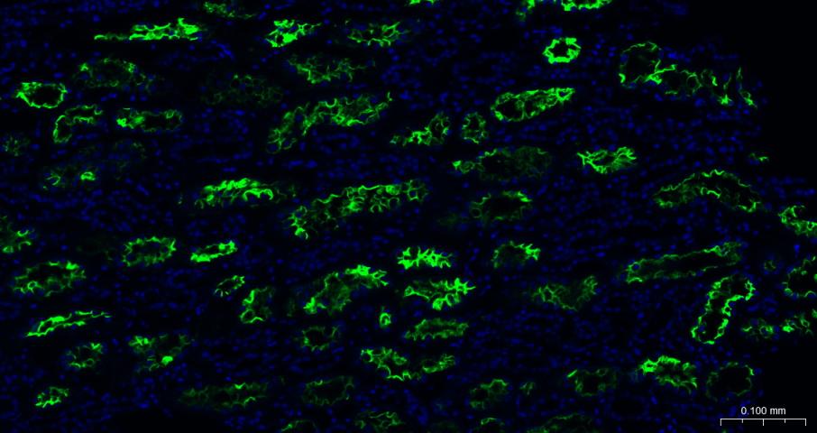 血管紧张素转换酶重组兔单抗