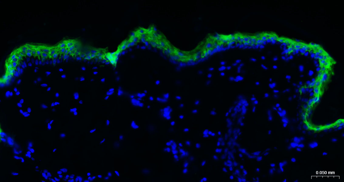 细胞角蛋白10重组兔单抗