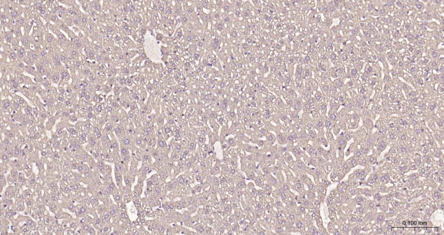 脂肪酸合成酶重组兔单抗