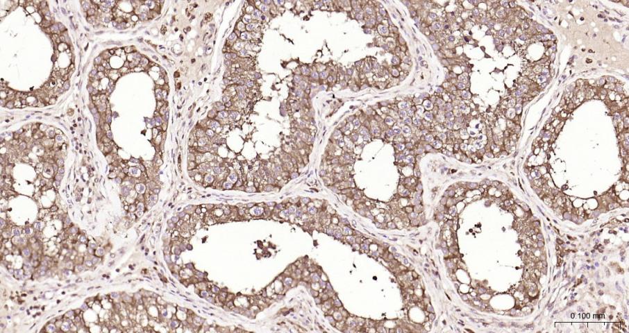 乳酸脱氢酶重组兔单抗