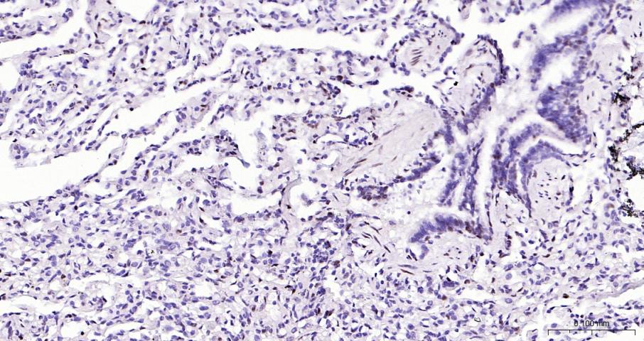 早期生长应答蛋白1重组兔单抗